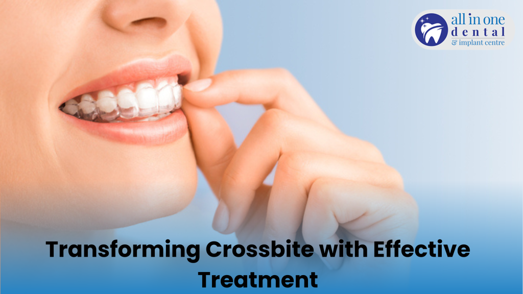 Crossbite Dental Treatment