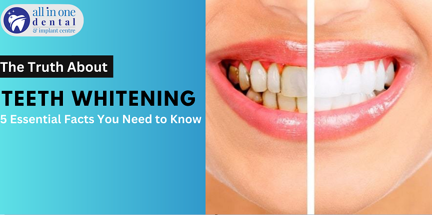 Truth About Teeth Whitening