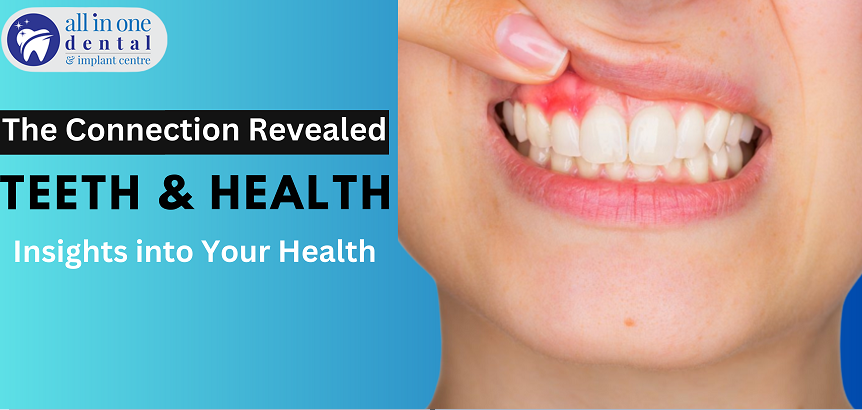 From Cavities to Cancer: What Your Teeth Can Tell You About Your Health