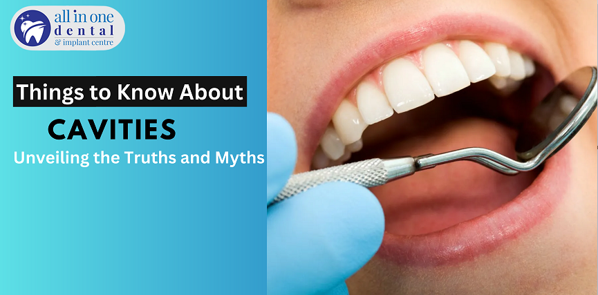 Things to Know About Cavities: Unveiling the Truths and Myths