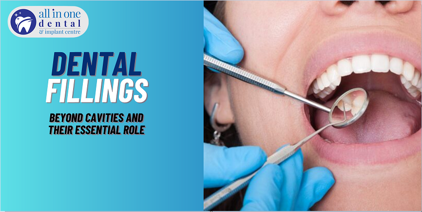 Beyond Cavities: When and Why Fillings are Essential for Oral Health