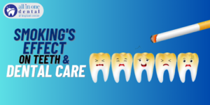 The Impact of Smoking on Teeth and Dental Treatments