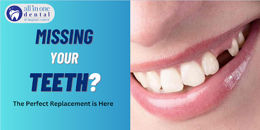 Are Your Teeth Missing? Modern Solutions for Tooth Replacement