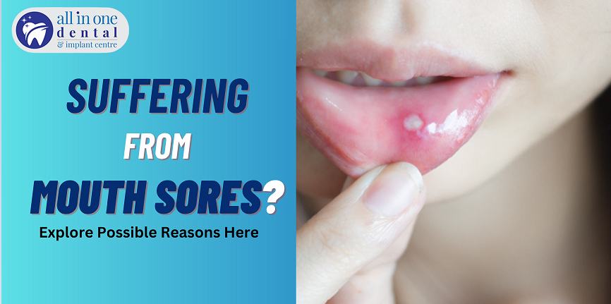 Are You Suffering from Mouth Sores? Understanding Causes, Types, and Treatment Options