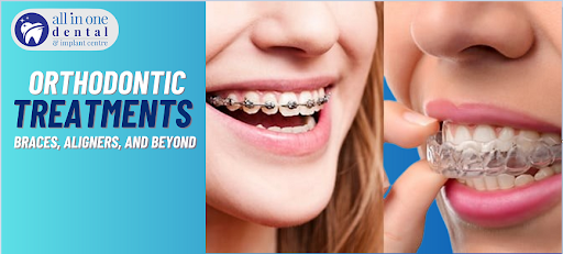 Exploring Orthodontic Treatments: Braces, Aligners, and Beyond