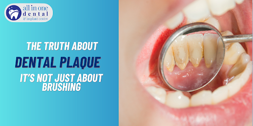 Dental Plaque - All in One Dental