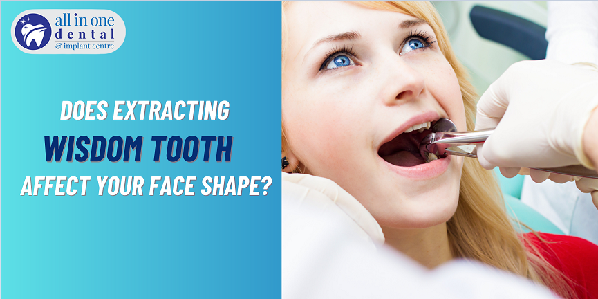 Does Extracting a Wisdom Tooth Affect Your Face Shape?