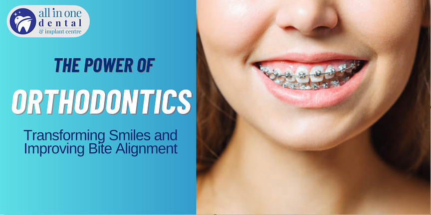 The Power of Orthodontics: Transforming Smiles and Improving Bite Alignment