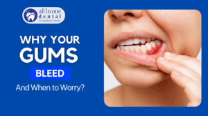 Why Your Gums Bleed (and When to Worry)