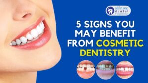 5 Signs You May Benefit from Cosmetic Dentistry