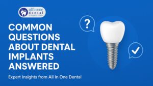 Common Questions About Dental Implants Answered – All in One Dental