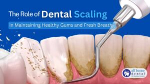 The Role of Dental Scaling in Maintaining Healthy Gums and Fresh Breath