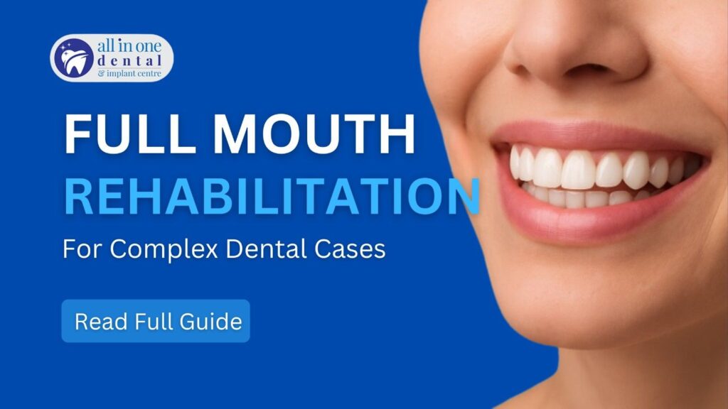 Full Mouth Rehabilitation: Restoring Function & Esthetics in Complex Cases