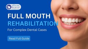 Full Mouth Rehabilitation: Restoring Function & Esthetics in Complex Cases