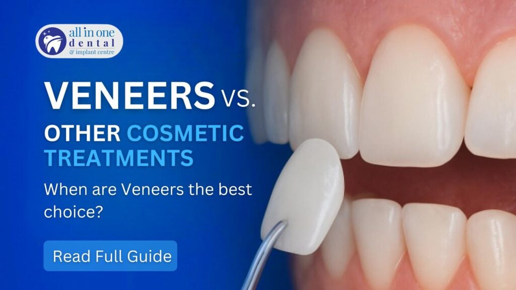 Veneers vs. Other Cosmetic Treatments: When Are Veneers the Best Choice?
