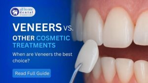 Veneers vs. Other Cosmetic Treatments: When Are Veneers the Best Choice?