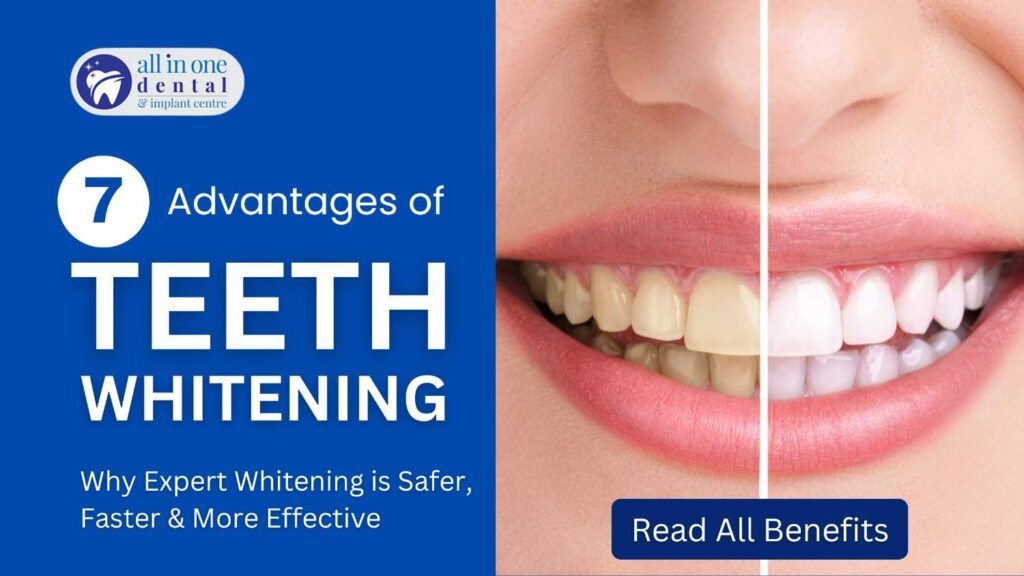 Teeth Whitening in spearwood - All in one Dental