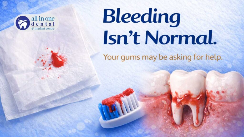 Gum Bleeding: When Should You Worry?