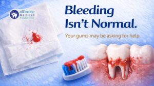 Gum Bleeding: When Should You Worry?