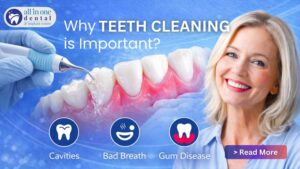 Why Teeth Cleaning is Important?