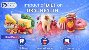 The Impact of Diet on Oral Health – All in One Dental