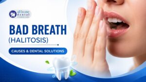 Bad Breath (Halitosis): Causes and Dental Solutions